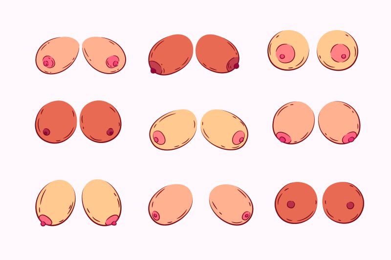 Graphiques de différents types de seins