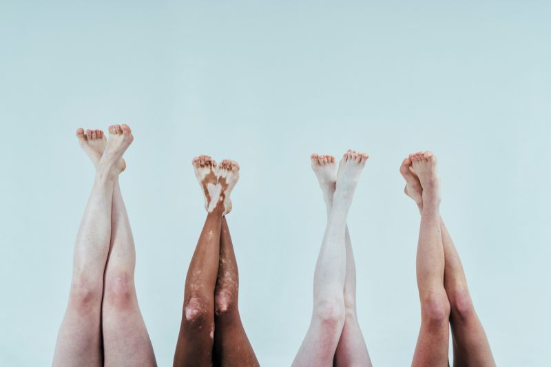 Legs and feet of women lying back with white background