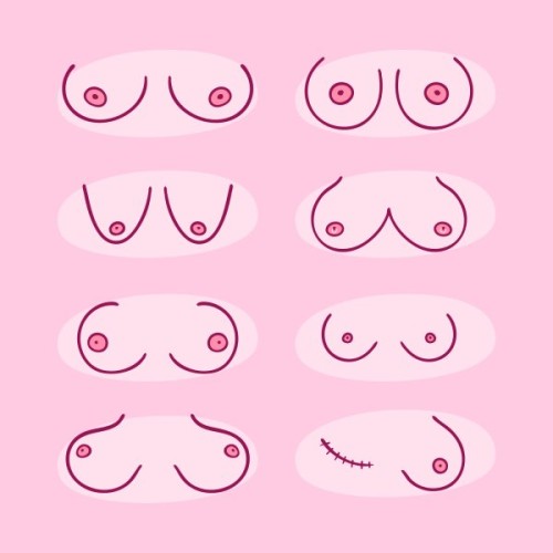 Breast Asymmetry: Why is One Boob Bigger Than The Other?